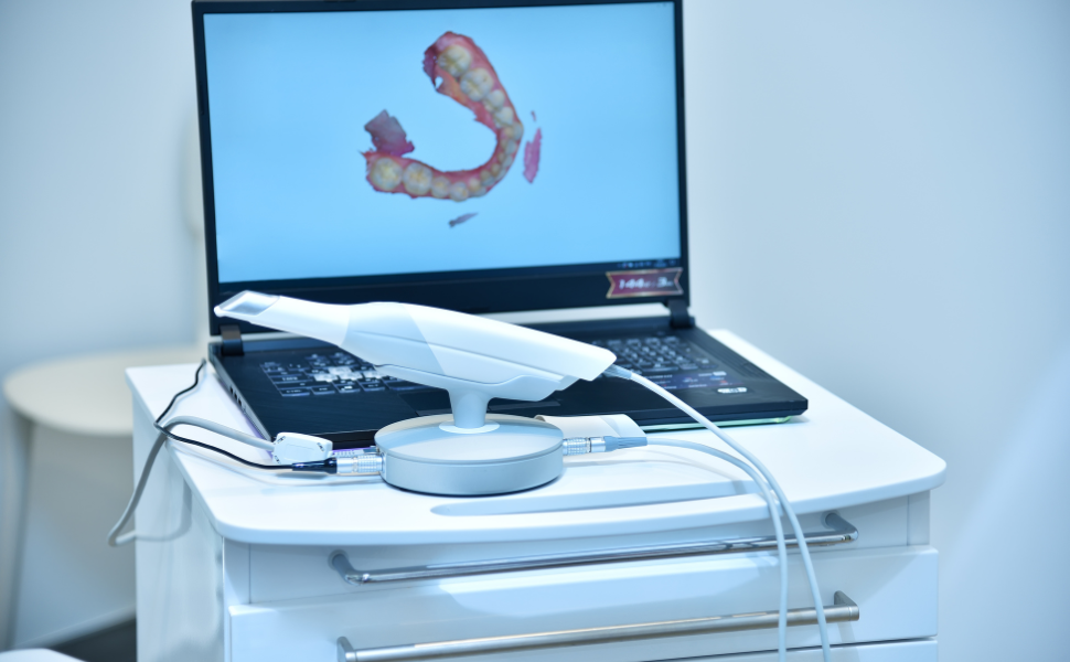 Ứng Dụng Máy Scan 3D Trong Miệng – Giải Pháp Đột Phá Cho Nha Khoa Hiện Đại